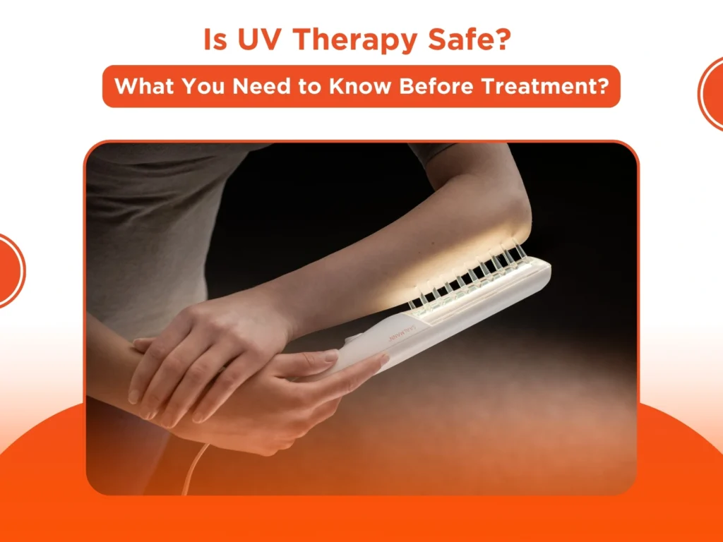 Is UV Therapy Safe? What You Need to Know Before Treatment?