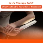 Is UV Therapy Safe? What You Need to Know Before Treatment?